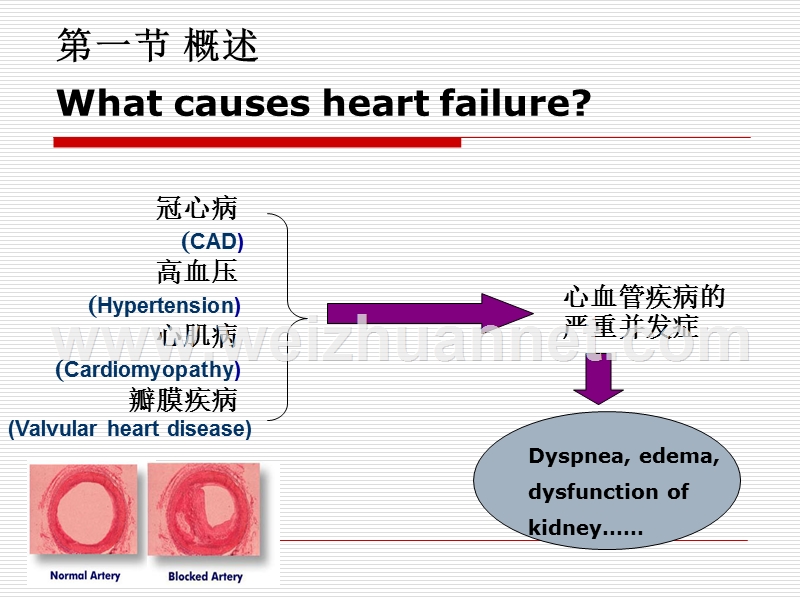 第十四章  心力衰竭（heart failure).ppt_第2页