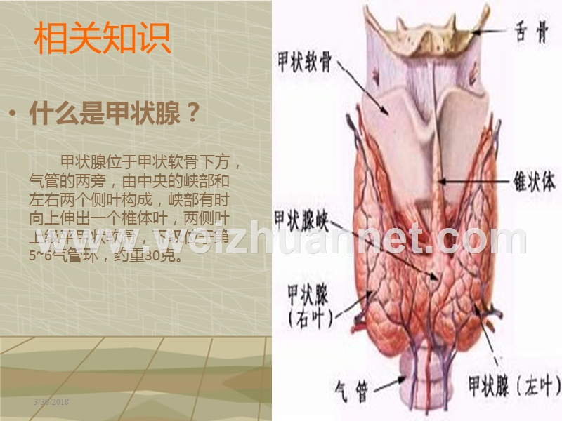 甲状腺肿护理查房.ppt_第3页