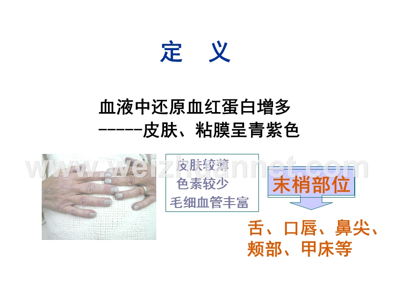 诊断学-发绀.ppt_第2页