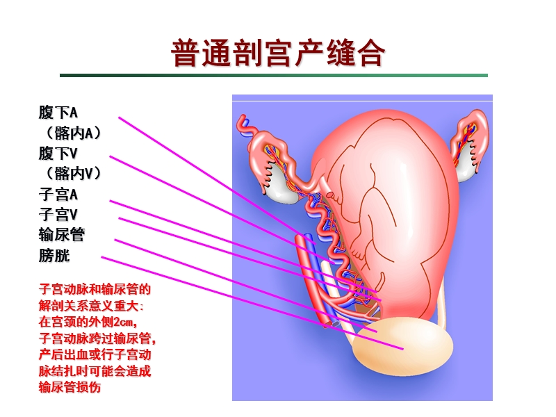 剖宫产手术缝合技术.ppt_第2页