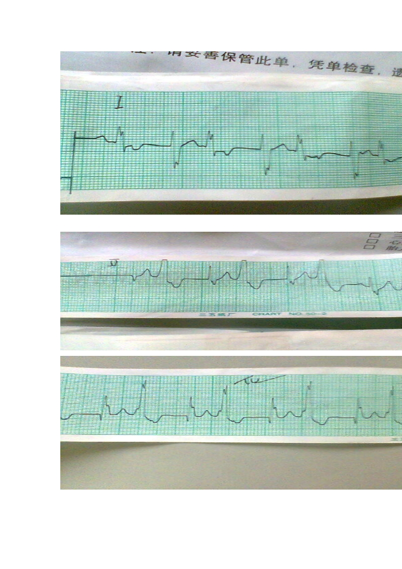 心电图疑难图集.doc_第1页