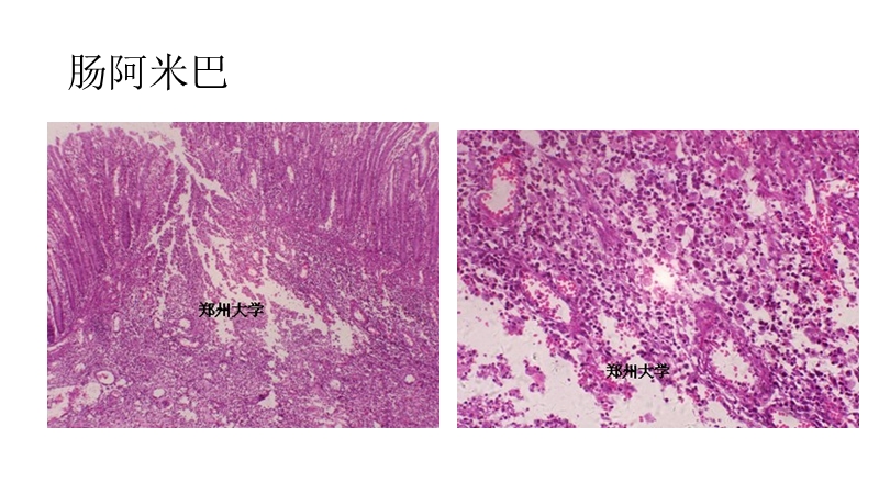 病理实验题库(镜下).ppt_第3页