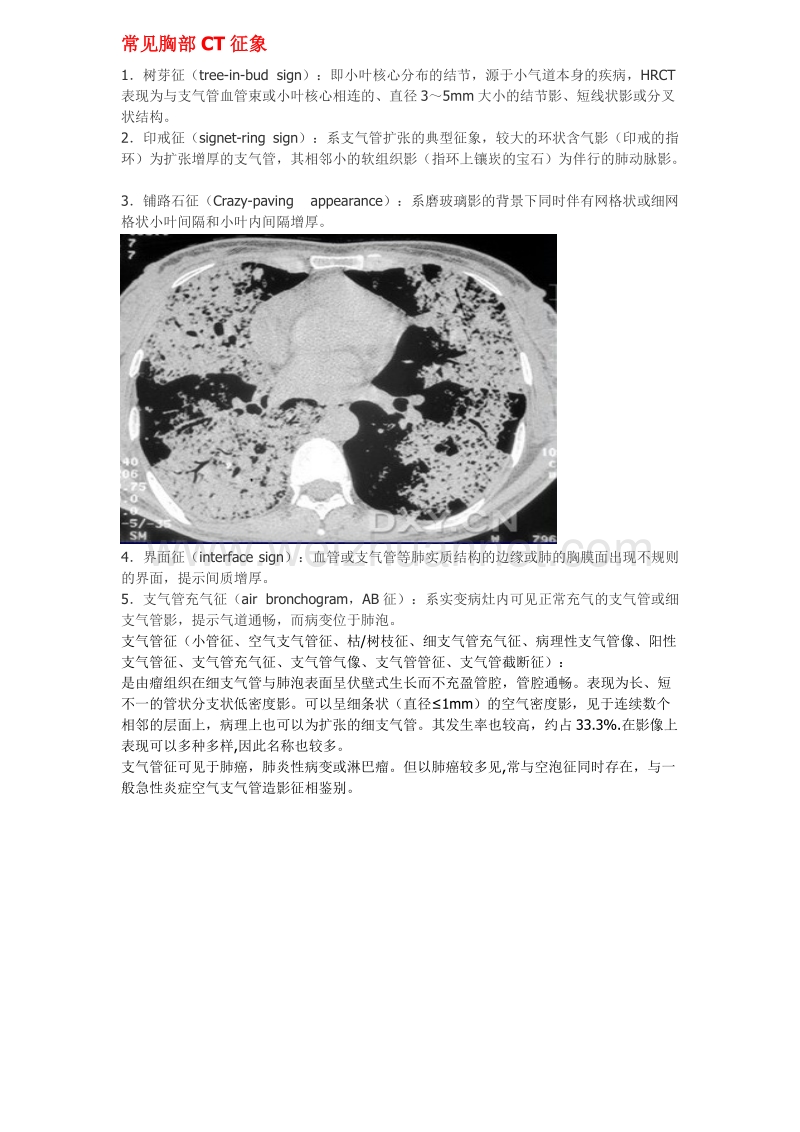 常见胸部ct征象.doc_第1页