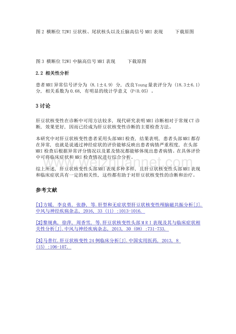 肝豆状核变性头部mri表现及其与临床症状相关性分析.doc_第3页