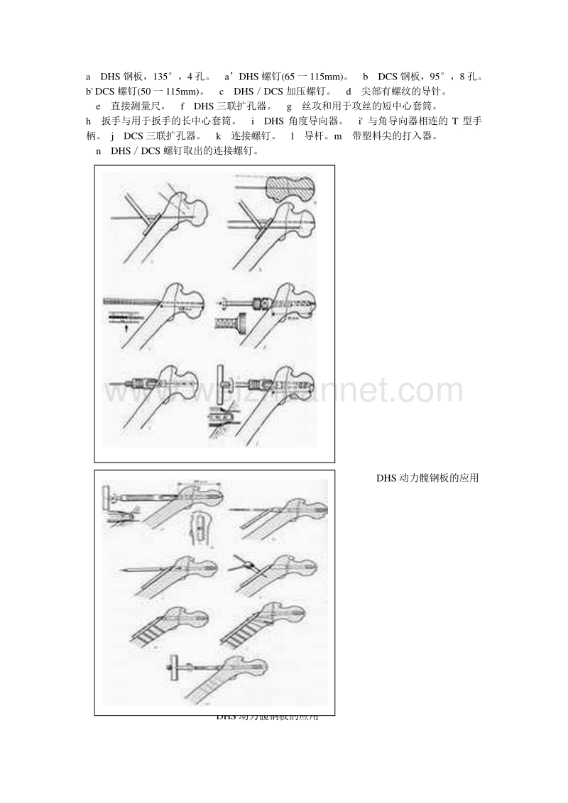 4richards型鹅头钉钢板使用说明4.doc_第2页