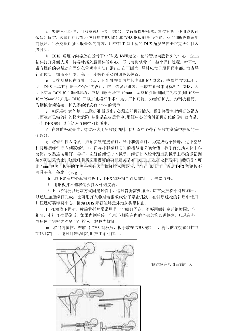 4richards型鹅头钉钢板使用说明4.doc_第3页