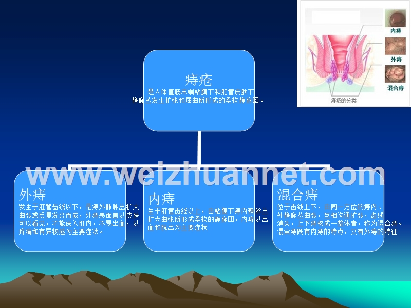 痔疮根治术.ppt_第2页