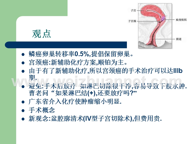 第十一章宫颈癌治疗新进展.ppt_第2页