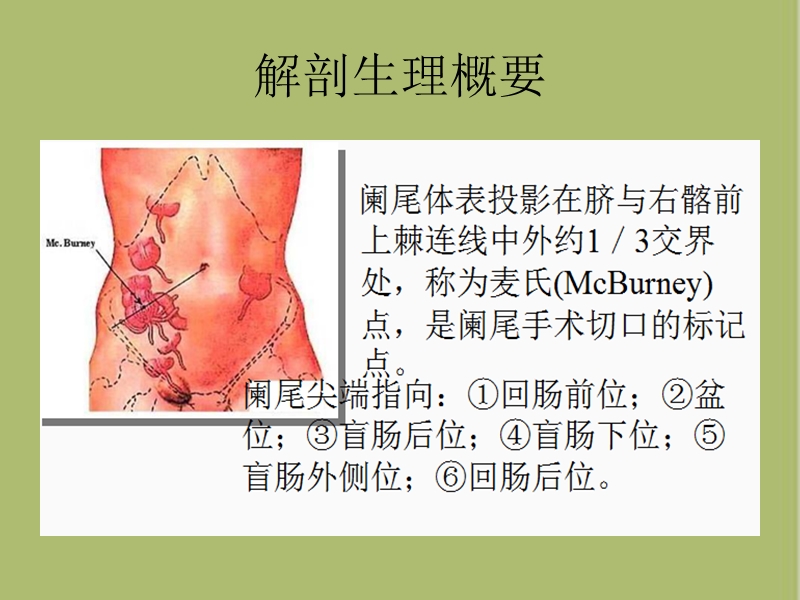 阑尾炎病人的护理.ppt_第2页