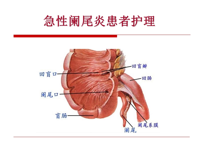 第13讲急性阑尾炎病人的护理.ppt_第1页