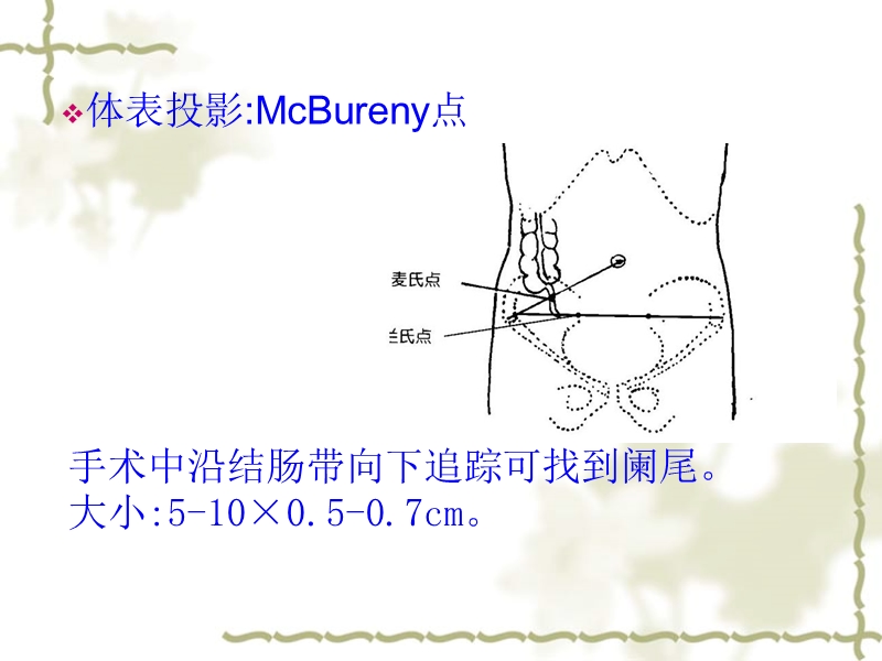 阑尾炎acute-appendicitis.ppt_第2页