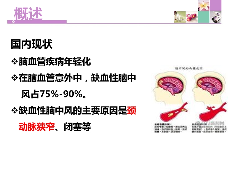 颈动脉内膜剥脱术护理.ppt_第3页