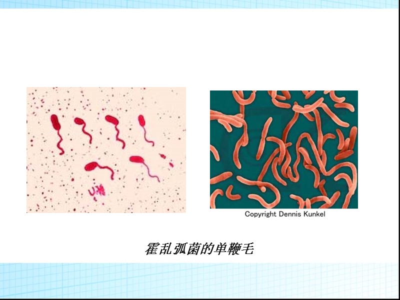 霍乱的护理.ppt_第3页