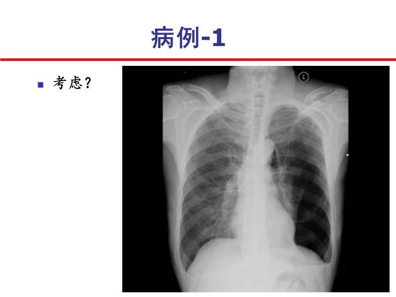 危重症患儿的早期识别.ppt_第3页