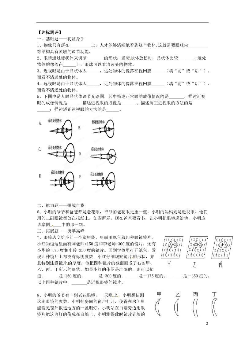 湖南省郴州市嘉禾县坦坪中学八年级物理上册 第五章 透镜及其应用 5.4 眼睛和眼镜学案（无答案）（新版）新人教版.doc_第2页