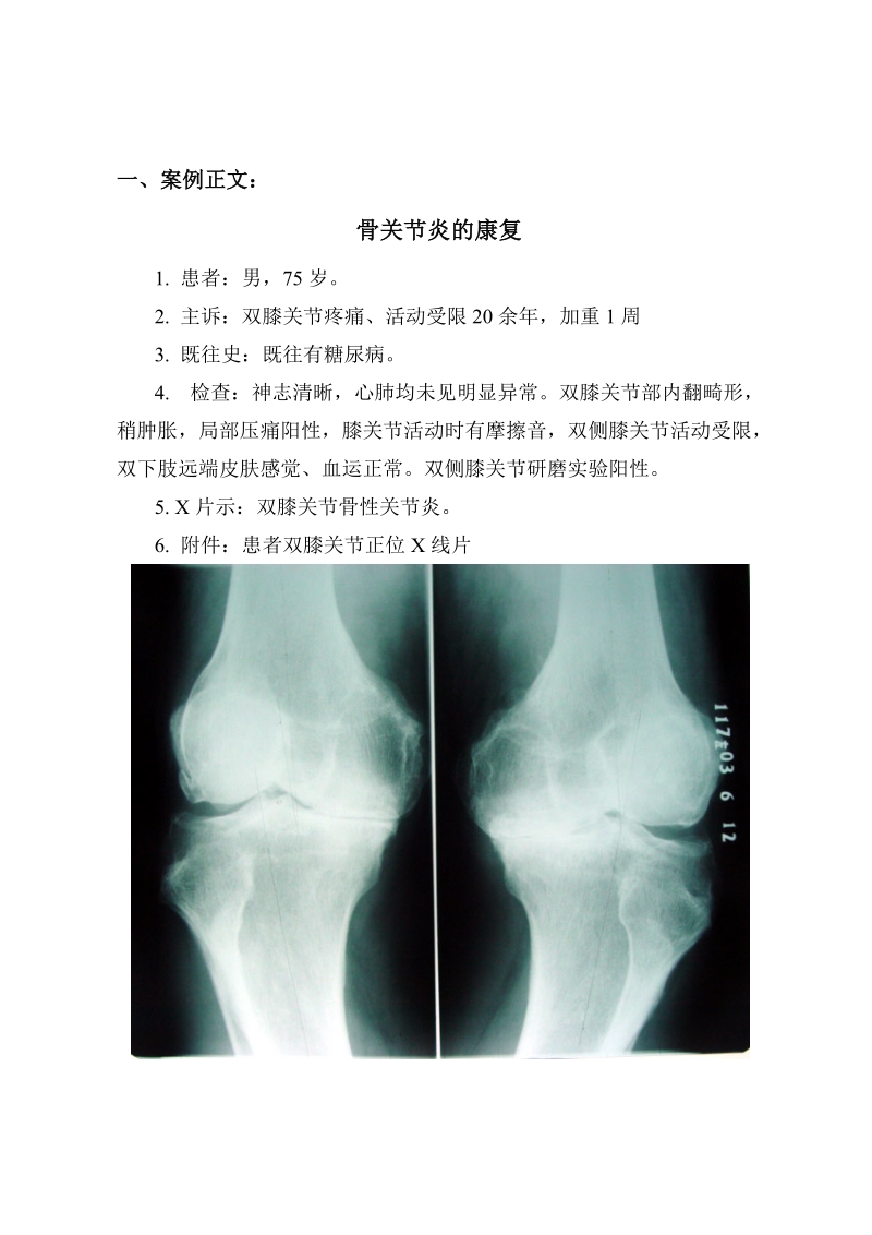 第12章-骨关节炎康复-案例教学.doc_第2页