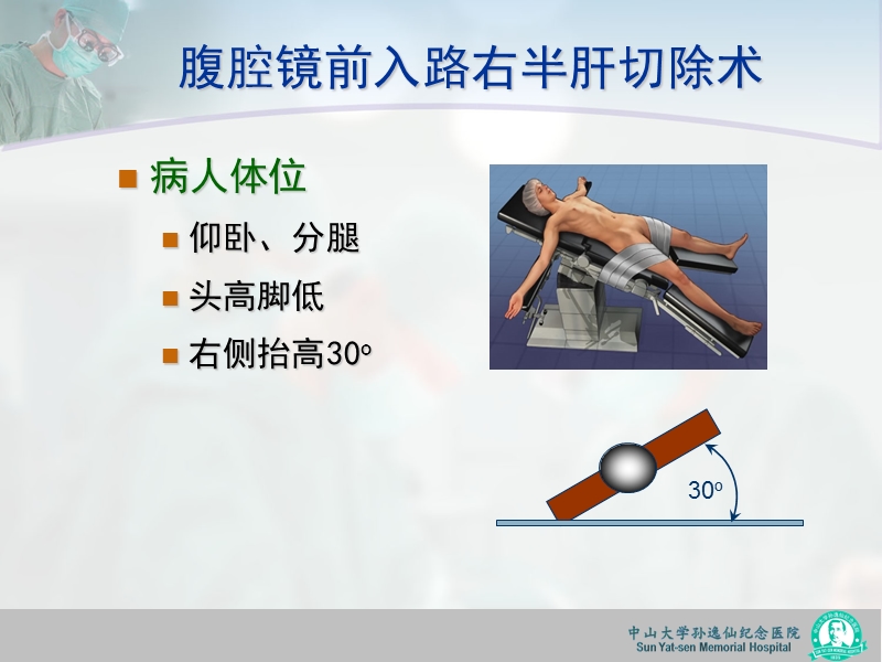 腹腔镜前入路右半肝切除术和中肝叶切除术.ppt_第3页