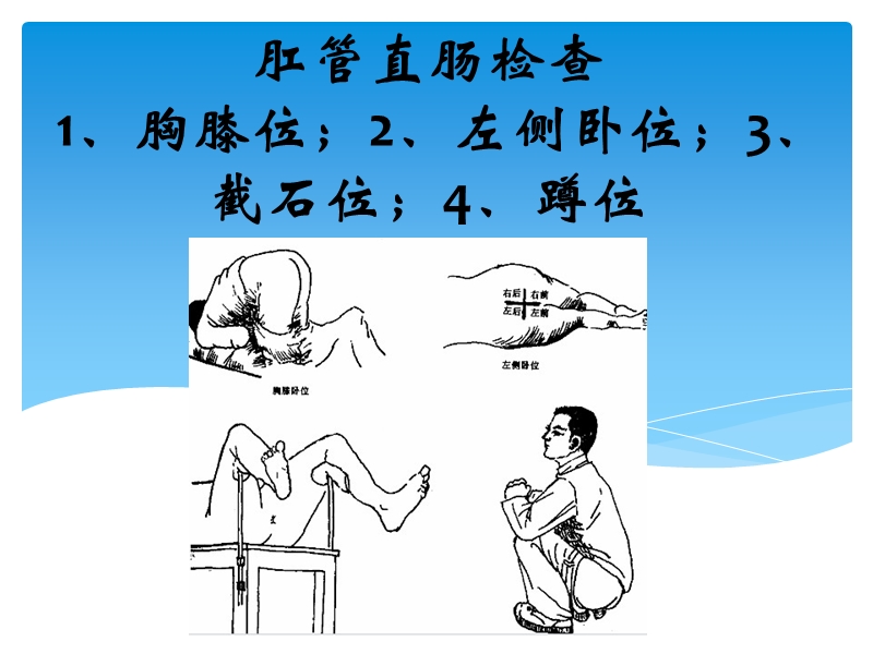 结直肠与肛门周围疾病.ppt_第3页