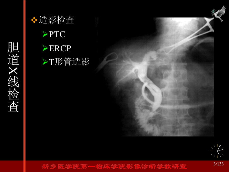 胆系疾病影像表现.ppt_第3页