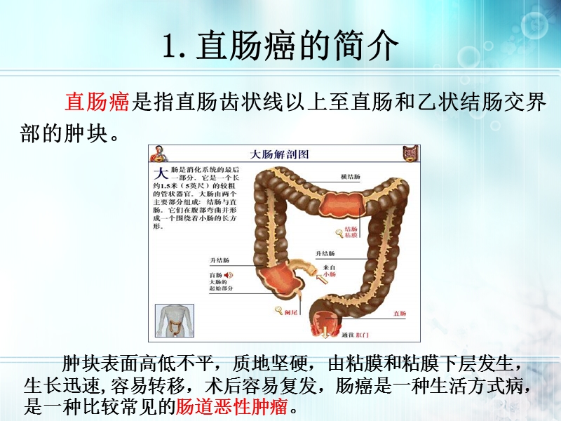 腹腔镜下直肠癌手术的配合.pptx_第3页