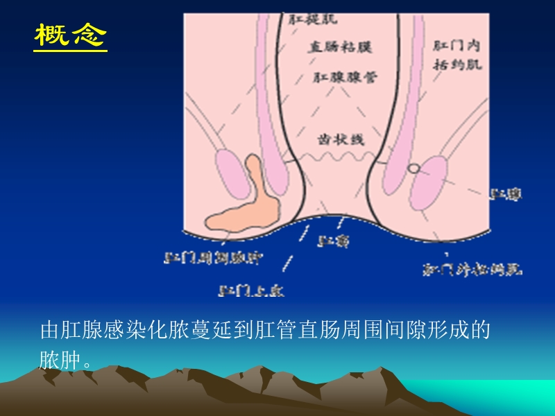 肛门直肠周围脓肿.ppt_第2页