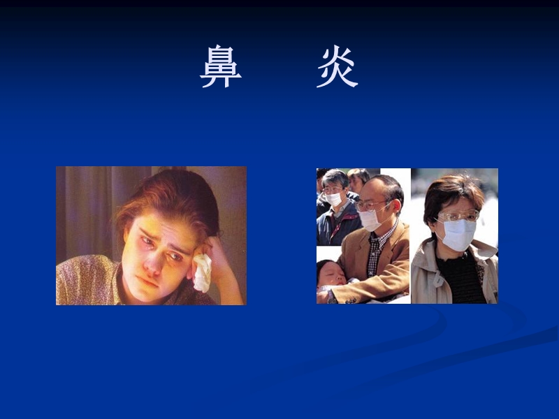 2.鼻炎的治疗与预防.ppt_第1页