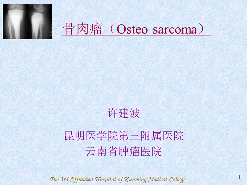 骨肉瘤(osteosarcoma)-ppt课件.ppt_第1页