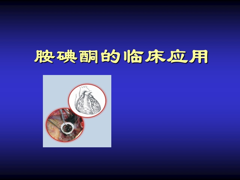 胺碘酮的临床应用.ppt_第1页