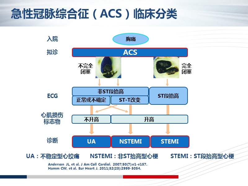 nste-acs诊断标准和治疗原则解读.ppt_第3页