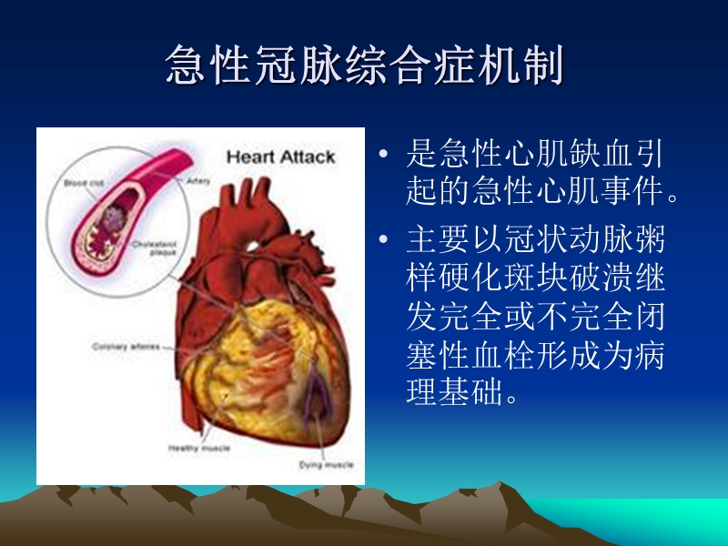 急性冠脉综合症pci时氯比格雷的合理应用.ppt_第2页