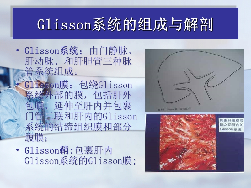 glisson蒂横断式肝切除.ppt_第2页