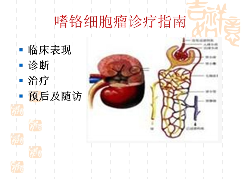 2011_年嗜铬细胞瘤诊疗指南.ppt_第2页