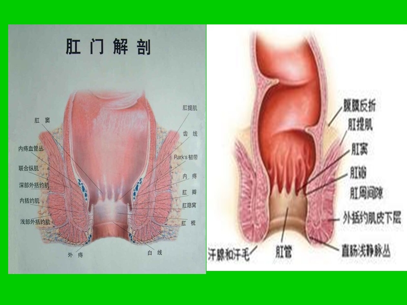 常见肛肠疾病及其 社  区  居   民.ppt_第2页