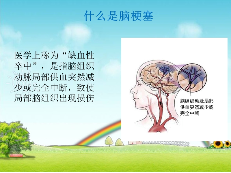 脑梗塞健康管理.ppt_第3页