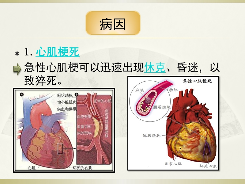 突发性猝死的应急预案及流程.pptx_第3页