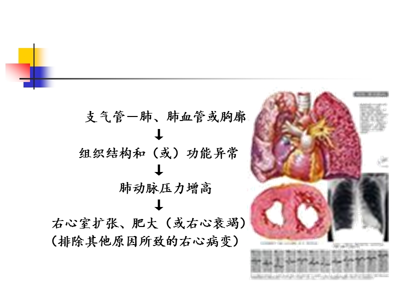 肺源性心脏病护理.ppt_第2页