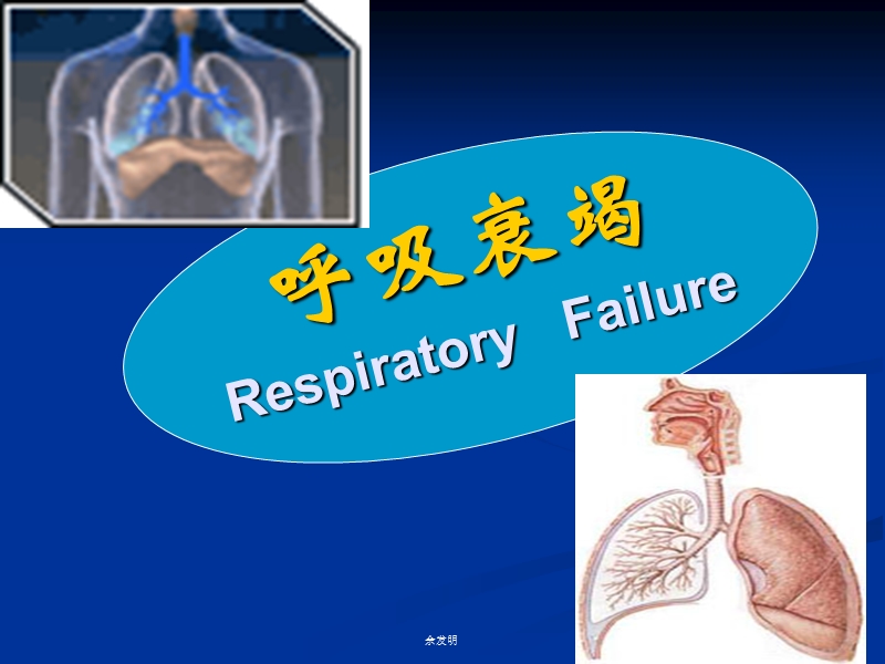 呼吸衰竭1.ppt_第1页