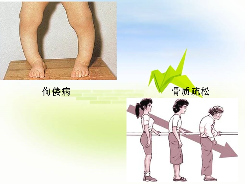 第十二章_骨代谢异常的生物化学诊断.ppt_第2页