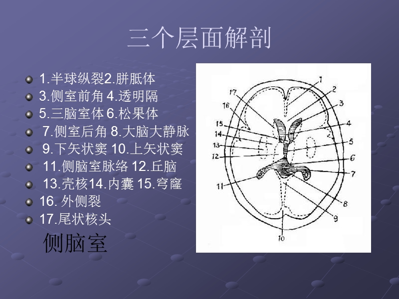 颅脑ct层面解剖.ppt_第3页