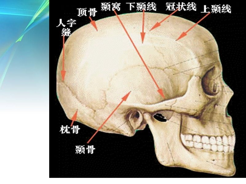 颅骨骨折的规范治疗.ppt_第3页