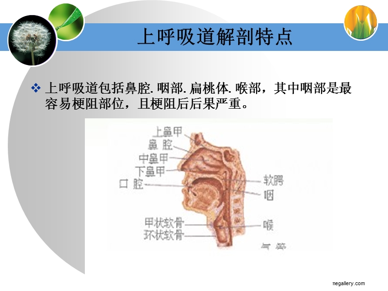 04-23口咽通气道的临床应用.ppt_第3页