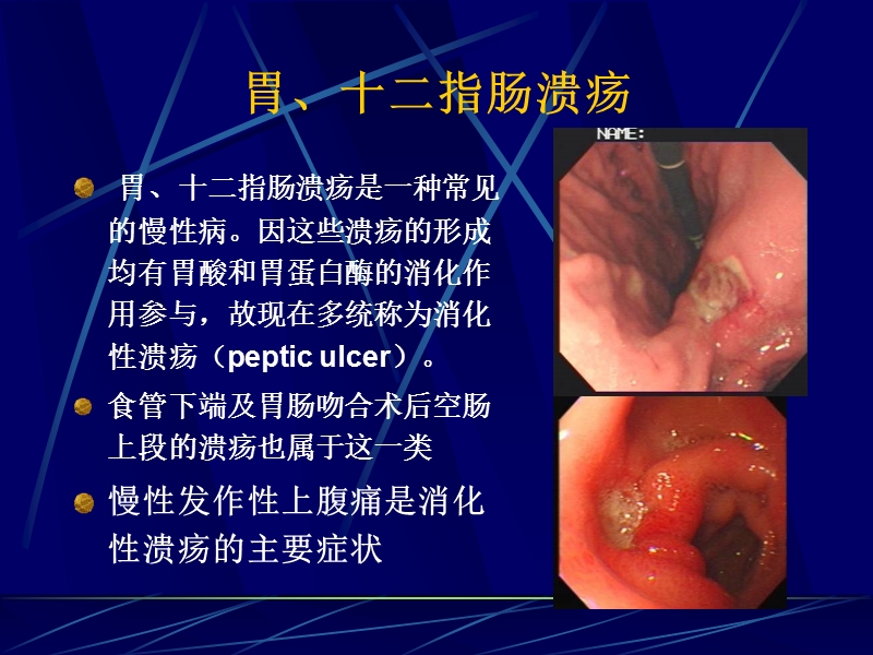 腹部常见病变的主要症状和体征2.ppt_第2页