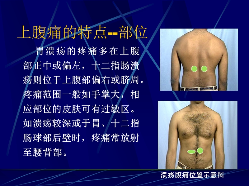 腹部常见病变的主要症状和体征2.ppt_第3页