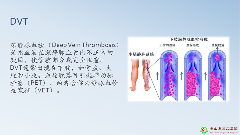 深静脉血栓预防.pptx_第3页
