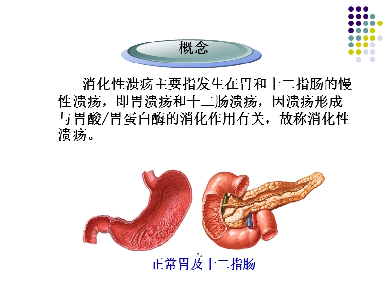 3第三节--消化性溃疡病人的护理.ppt_第3页