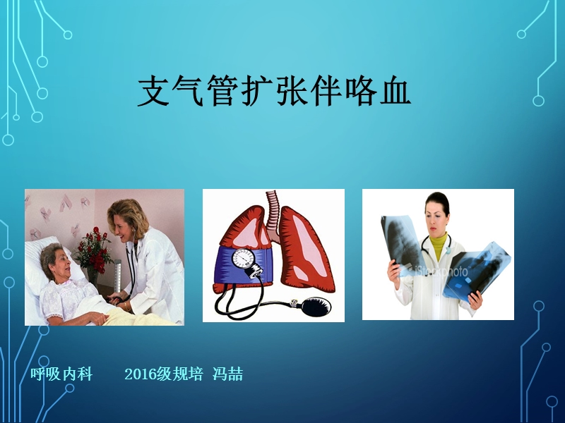 支气管扩张伴咯血.ppt_第1页