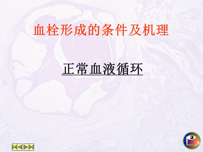 血栓形成.ppt_第3页