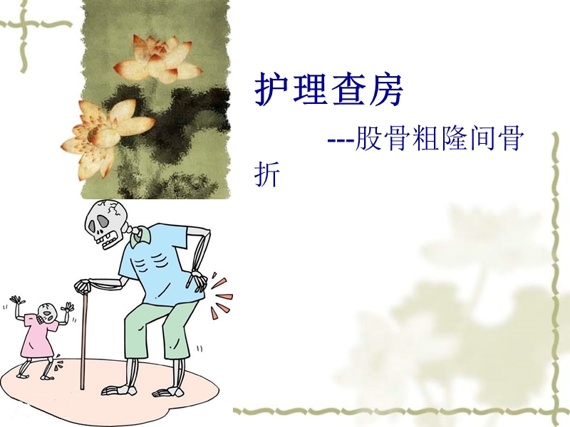 股骨粗隆间骨折护理查房.ppt_第1页