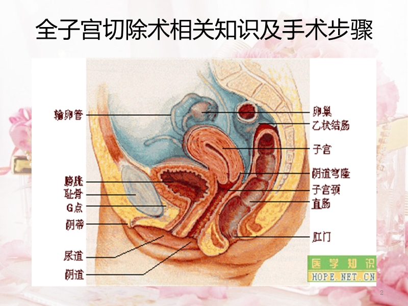 经腹全子宫切除术相关知识及手术步骤.pptx_第2页