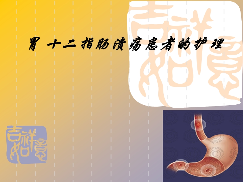 胃十二指肠溃疡.ppt_第1页